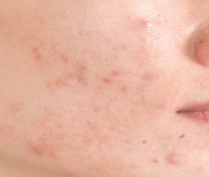 Harmful Makeup Ingredients